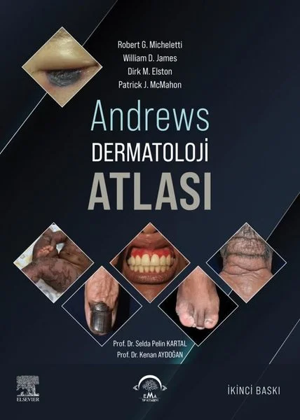 Andrews Dermatoloji Atlası (Ciltli)